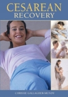Cesarean Recovery артикул 11681d.